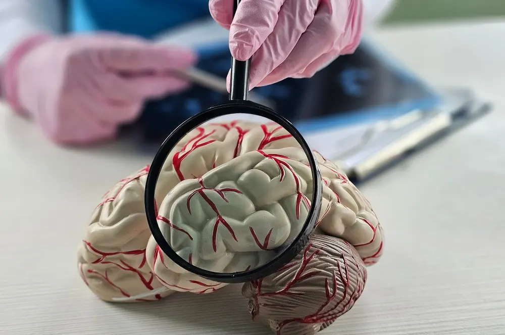 Stroke Misdiagnosis Guide: Recognizing Negligence & Pursuing Compensation in New York