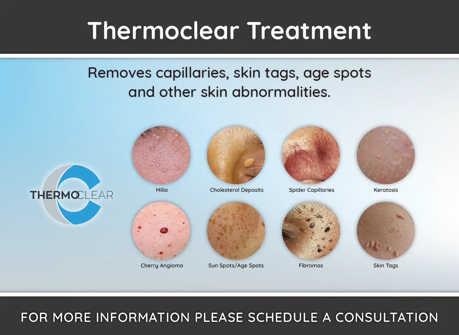 New Spa Services - Thermoclear Treatment