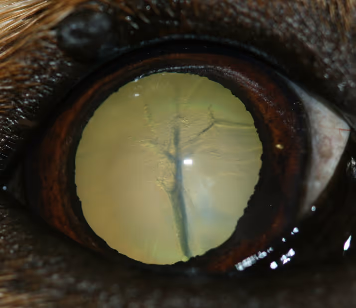 Webinar: Indicaciones para los pacientes con cataratas: ¿Cuándo operar y cuándo no operar?