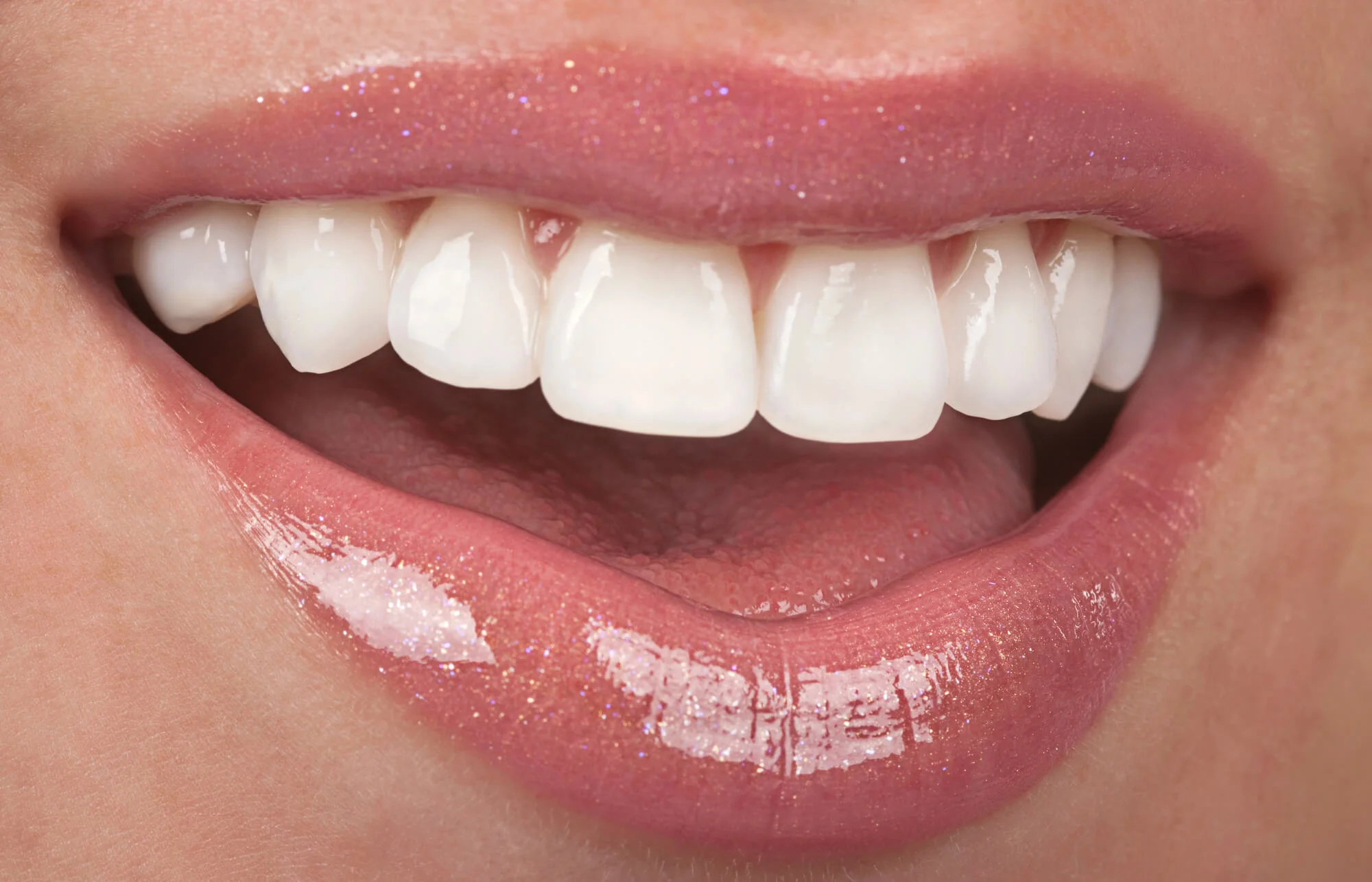 Close-up of healthy, bright smile after dental restoration – Full arch dental implants