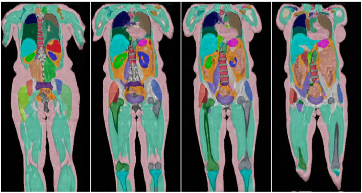 100,000 Whole-Body Scans Reveal Why Early Imaging Is the Future of Preventive Care