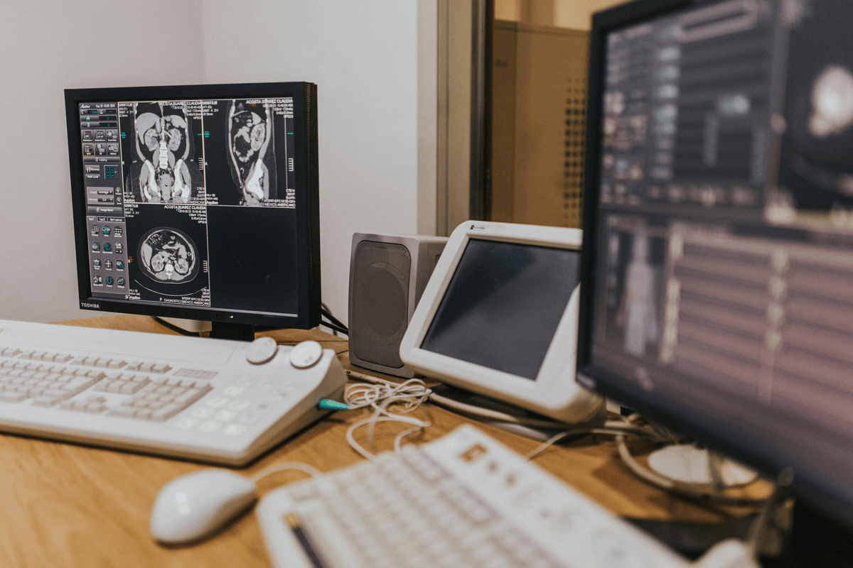How Early Detection is Changing Liver Cancer Care