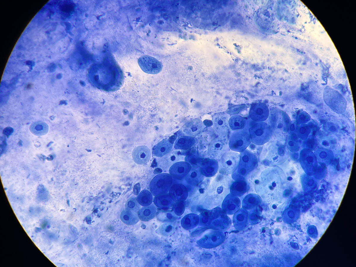 Methylene Blue Myths: Science, Hype, and Unknowns