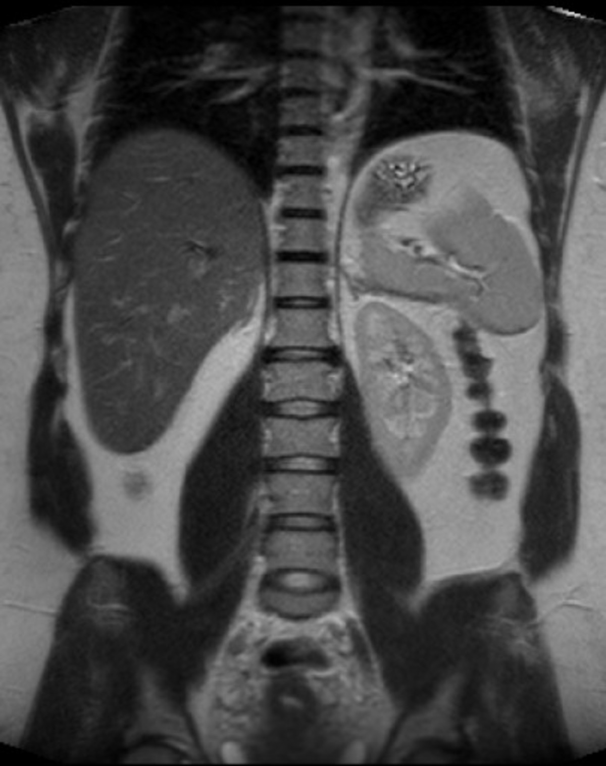 Cancer Screenings Explained: Which Tests You Need and When