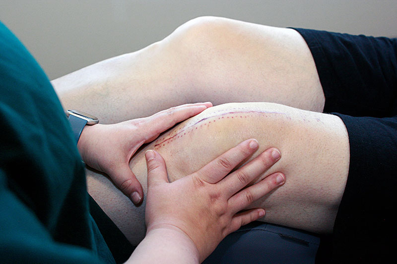 Physiotherapeutin behandelt Operations-Narbe