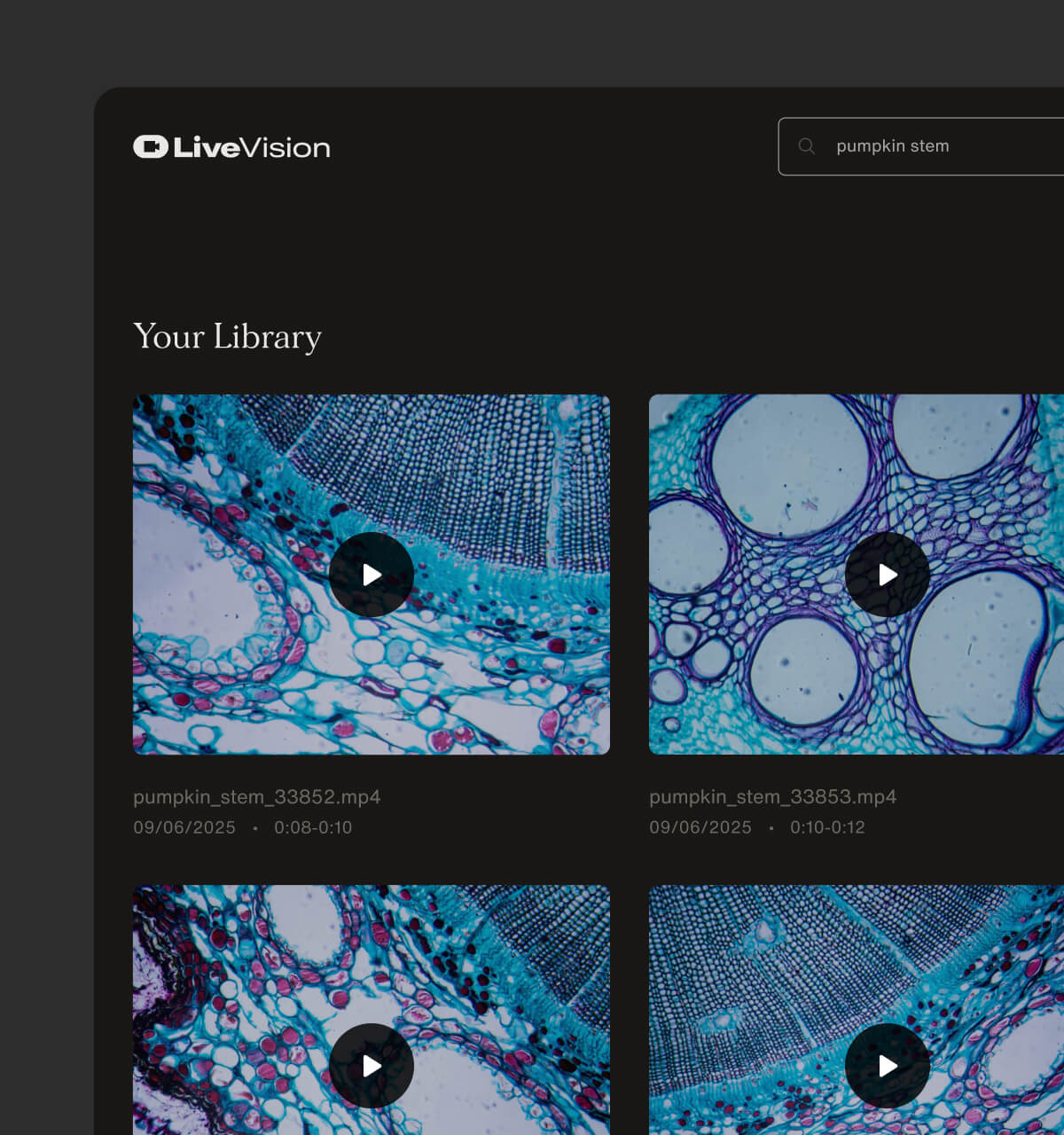 The LiveVision platform with a library of medical videos that are showing different cellular cross-sections of pumpkin stems for analyzing.