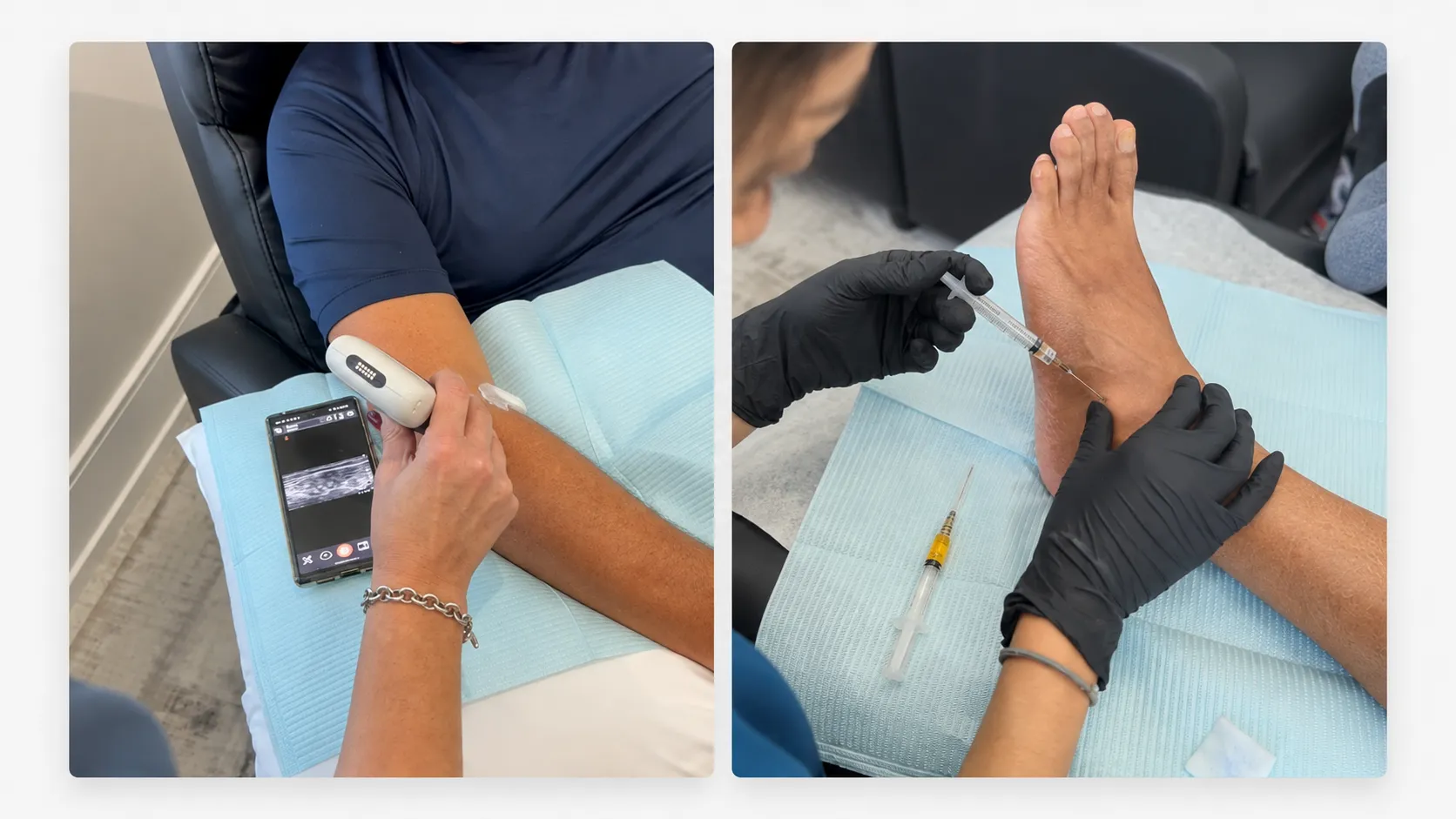 Ultrasound scan of the elbow and a guided PRP injection at the foot