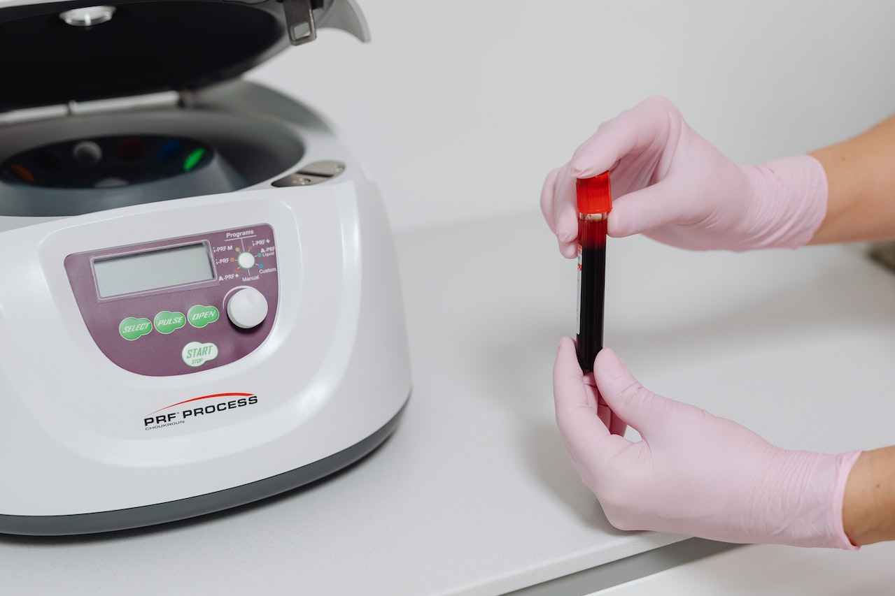 PRP blood sample tubes