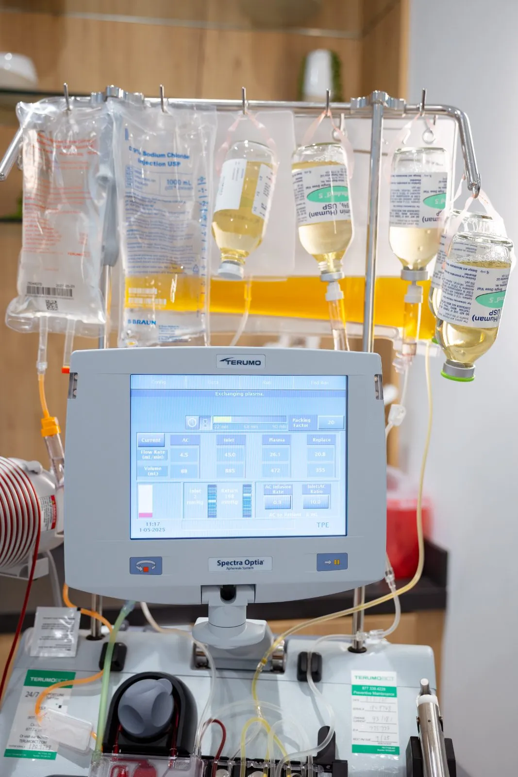 Apheresis system exchanging plasma during a TPE session