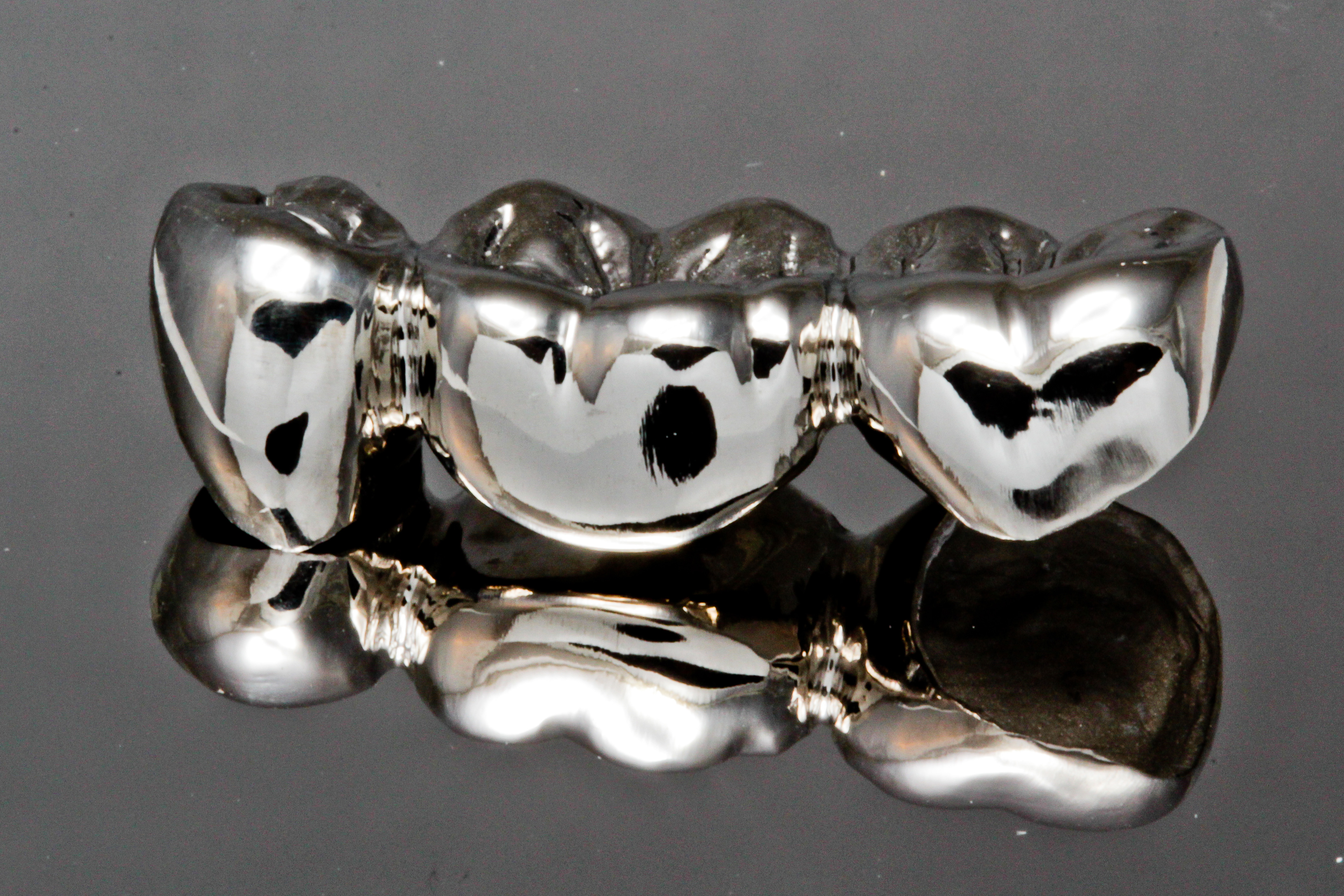 Porcelain Fused to Metal (PFM) Crowns: Strength, Esthetics & When to Use Them