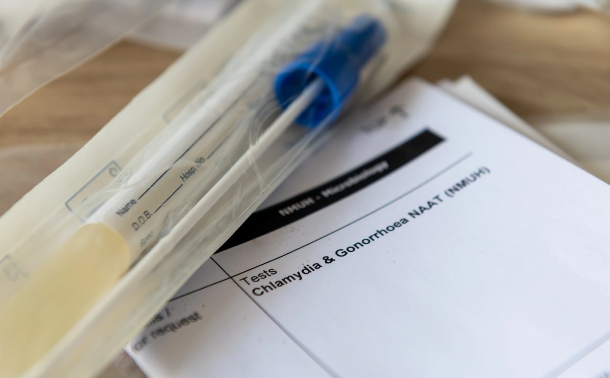 STI diagnoses remain high in England despite declines in some infections