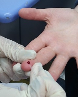 Exame de DST realizado pelo Centro de Tratamento e Acolhimento da Prefeitura de São Paulo