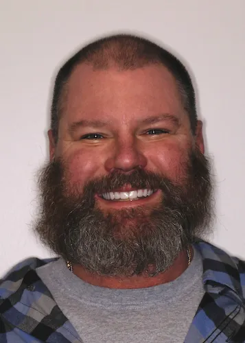 A man with a warm smile on his face, radiating happiness with his new smile.