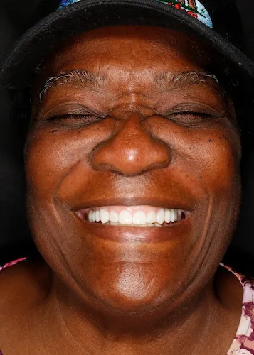Woman smiling after dental treatment at Smiles Family Dentistry