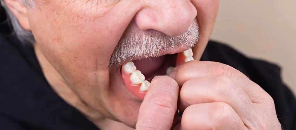 Implant Overdentures