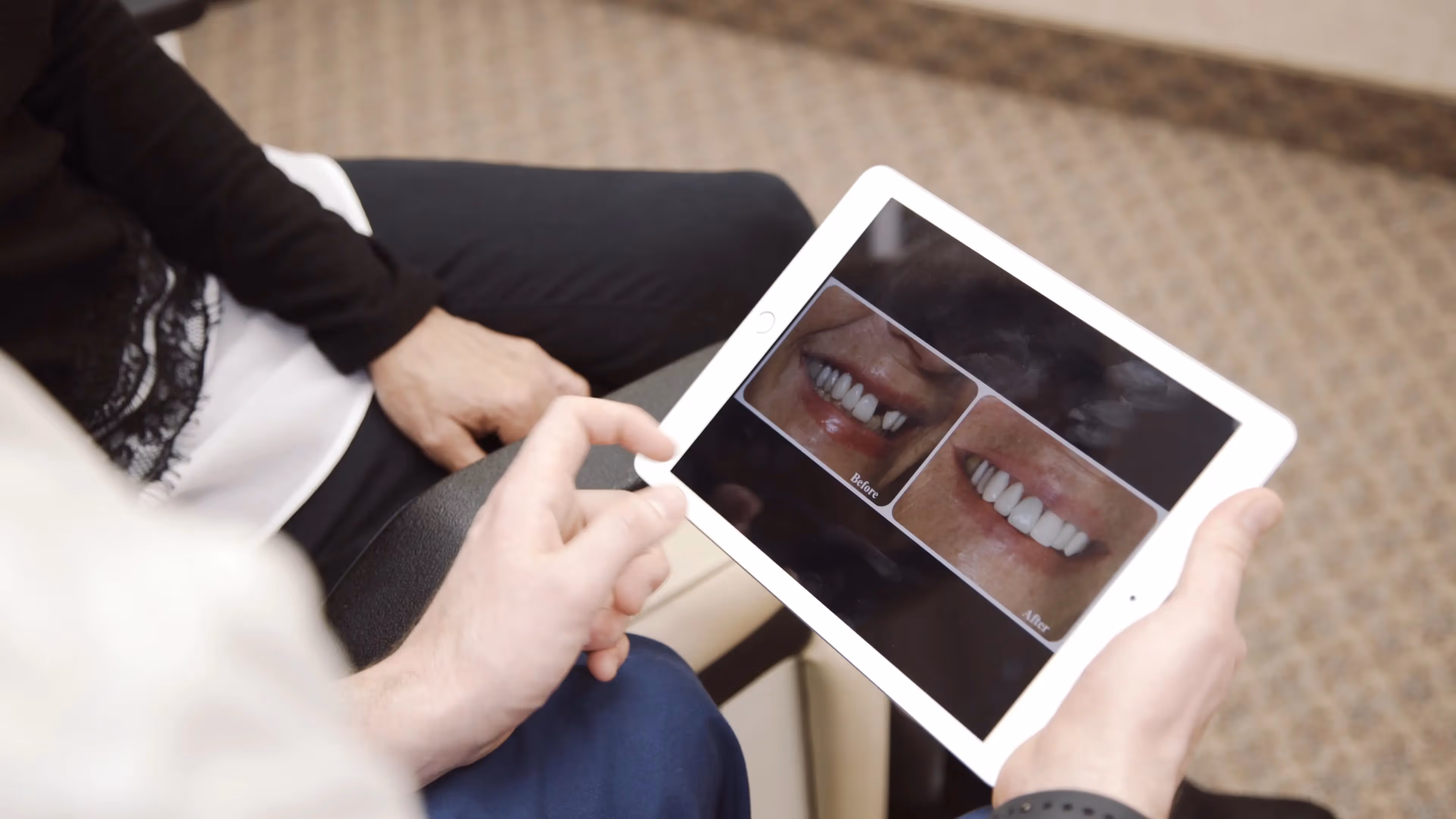 Dental Implants