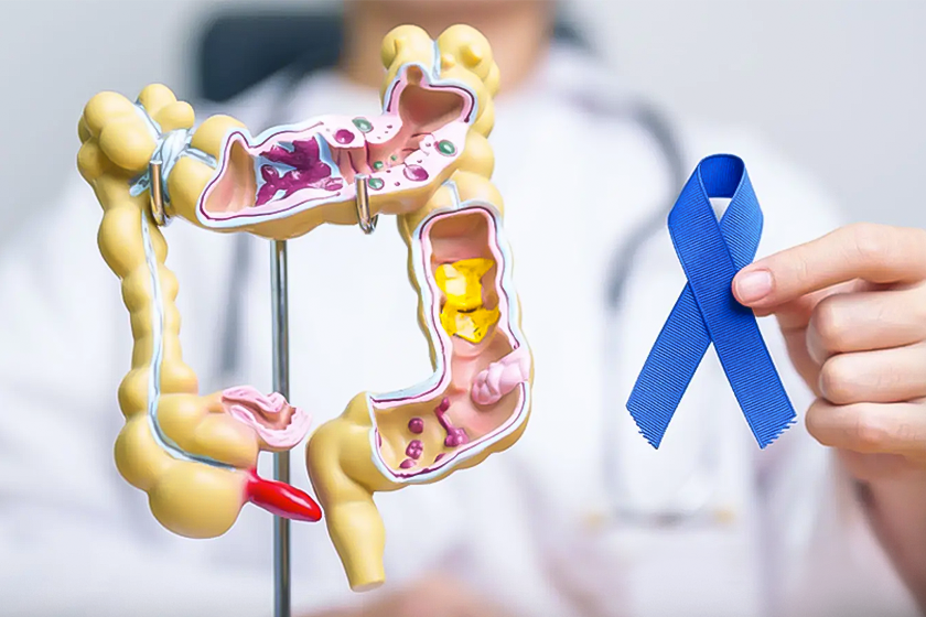 March Health Observance: Colorectal Cancer Awareness Month