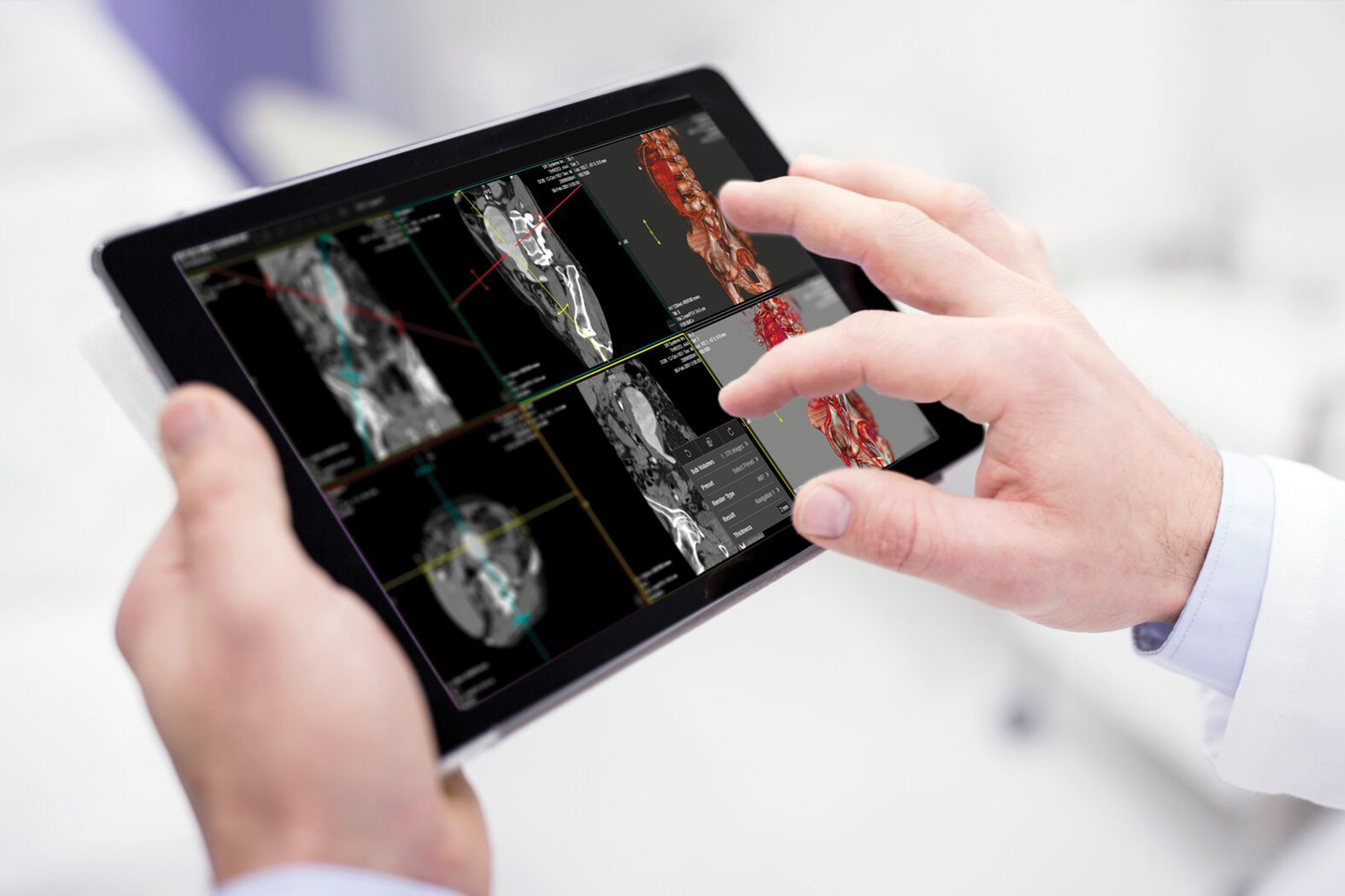 April Health Observation: Musculoskeletal (MSK) Awareness 