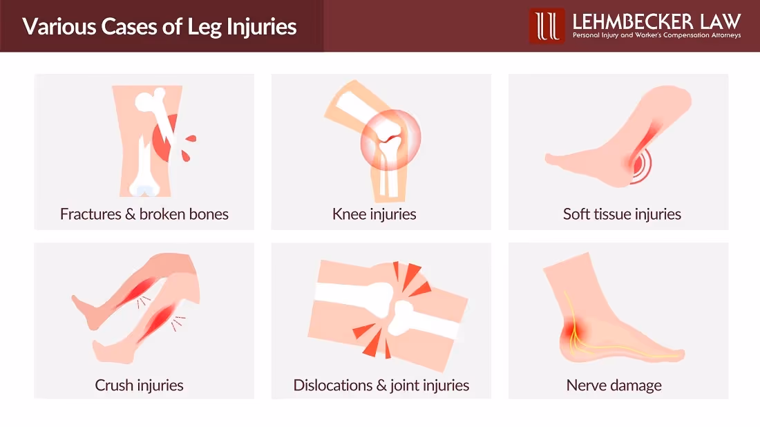 Various Cases of Leg Injuries: Infographic