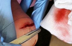 toddokline-instagram