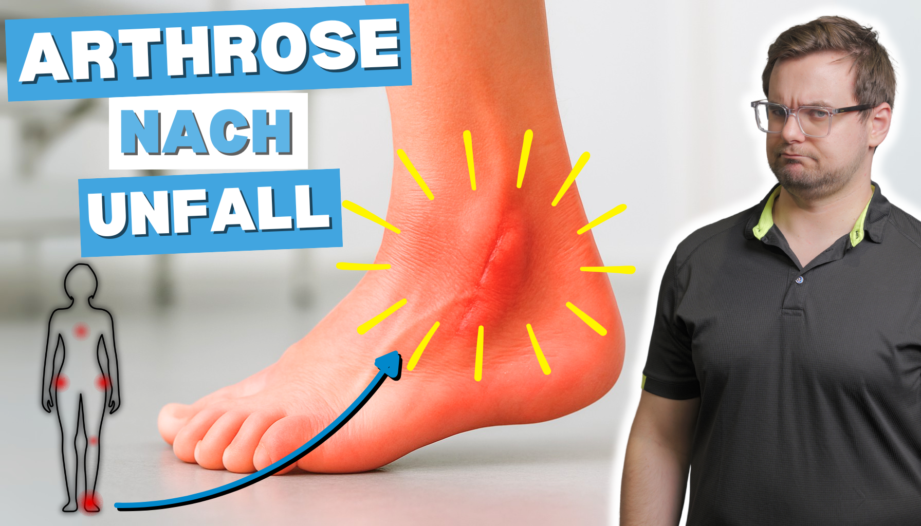 Physiotherapie Bonn: Schmerzen im Sprunggelenk nach Unfall — Warum Arthrose versteift und was jetzt hilft