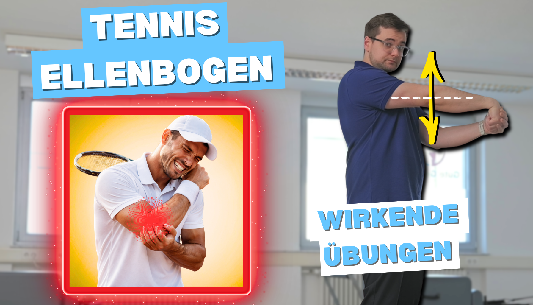 Physiotherapie Bonn: Tennisellenbogen (M77.1) verstehen, Ursachen erkennen und mit gezielten Übungen entlasten