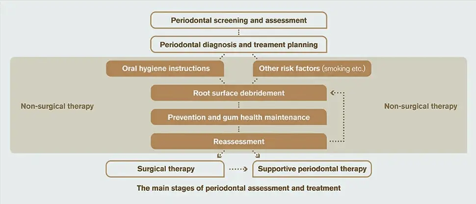 Flowchart of periodontal treatment: screening and assessment, then diagnosis and treatment planning; non-surgical therapy (oral hygiene instructions, managing risk factors such as smoking, root surface debridement, prevention and gum health maintenance) followed by reassessment, which leads back to debridement, to surgical therapy, or to supportive periodontal therapy