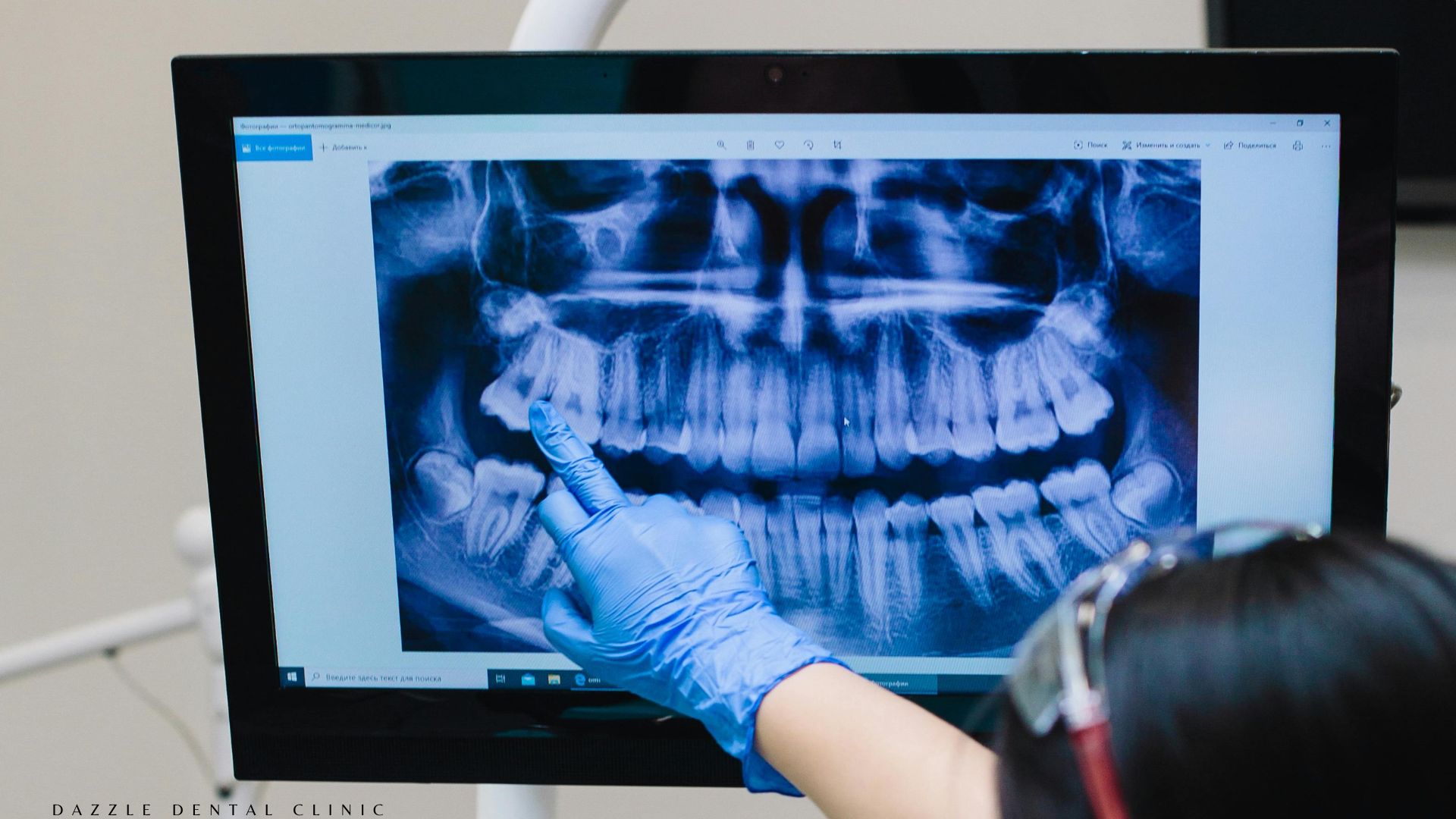 State-of-the-Art Dental Imaging (CBCT, Digital X-rays & OPG)