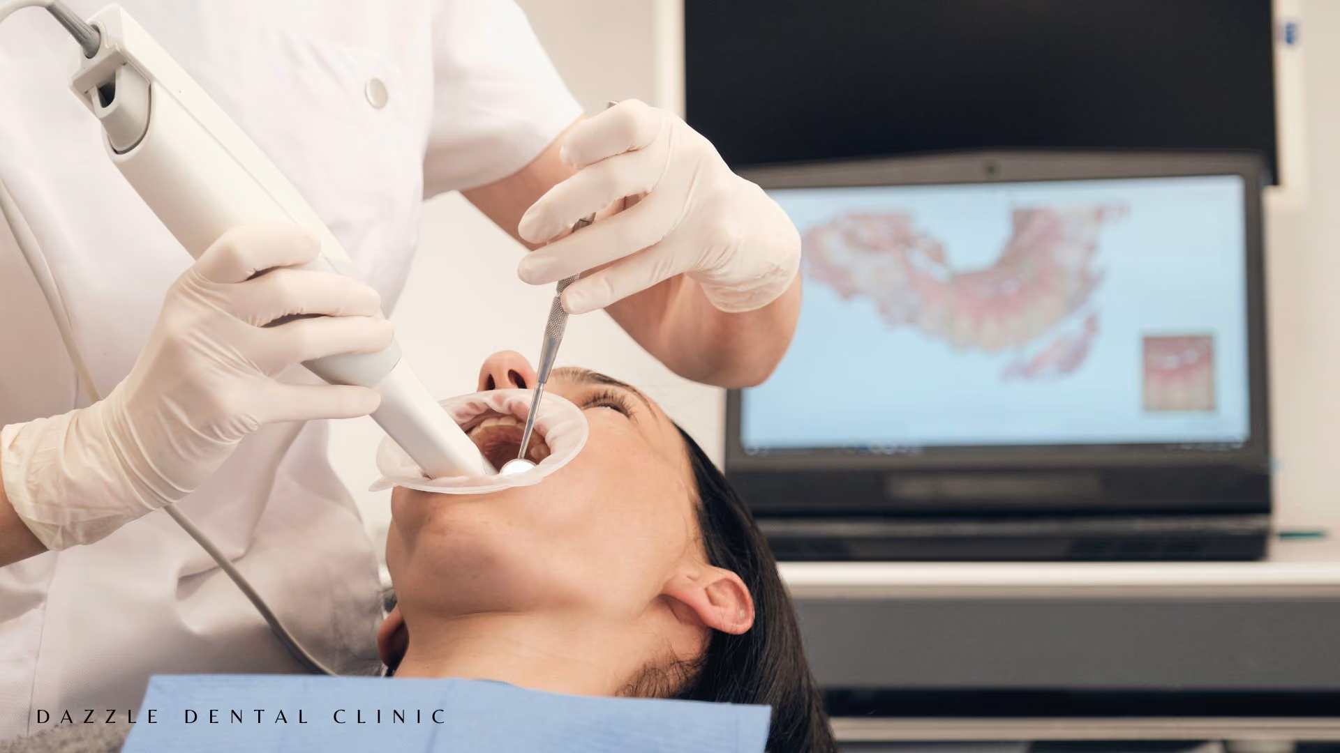 CBCT 3D Scanning at Dazzle Dental Clinic: What High-Resolution Imaging Means for Implant Planning, Root Canals, and Surgical Safety