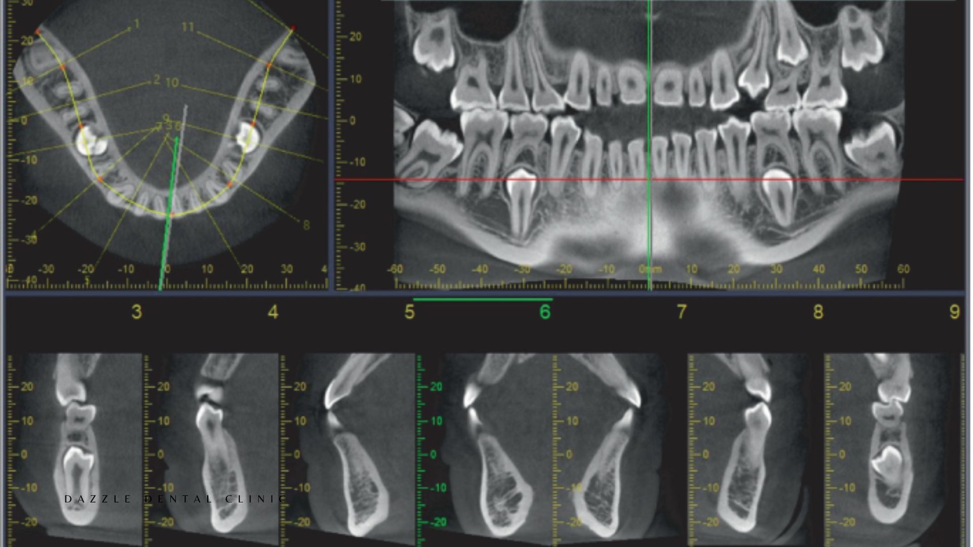 Specialized Radiographic Techniques for Complex Dental & Maxillofacial Care