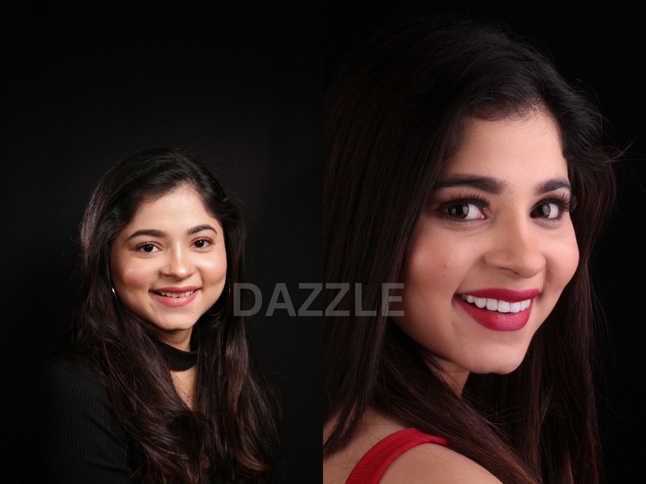 Before and after smile makeover: young woman's smile with brighter, more uniform teeth