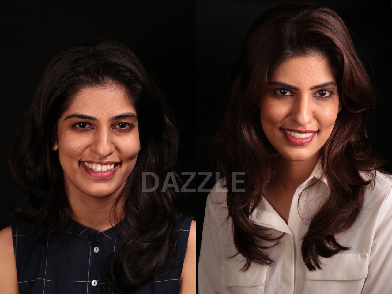 Before and after smile makeover: young woman's teeth made whiter and more even
