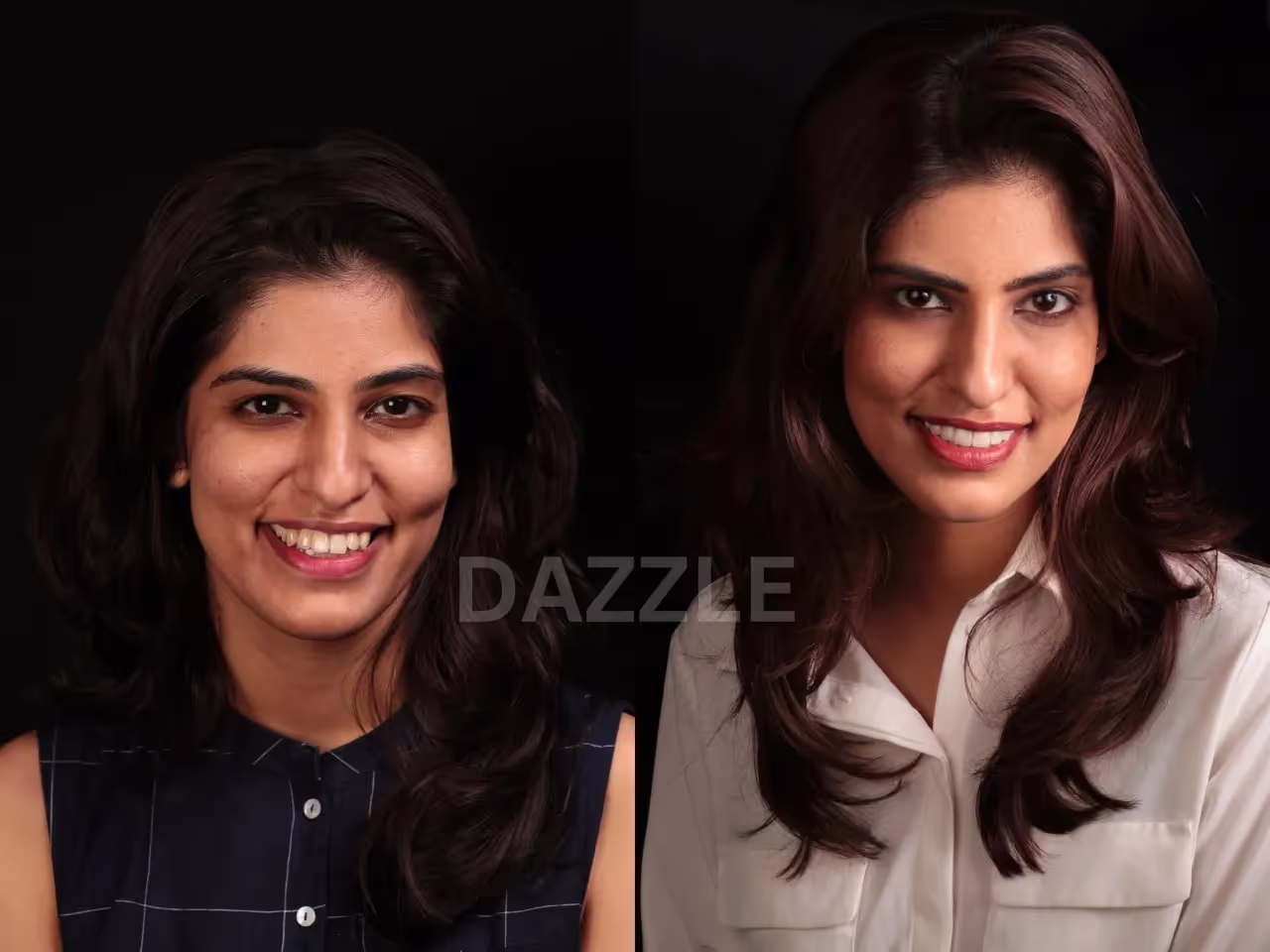 Before and after smile makeover: young woman's teeth made whiter and more even