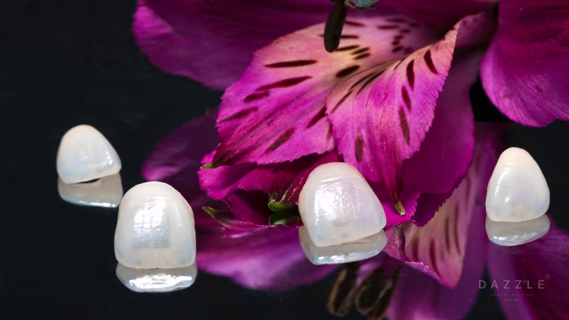 Removable vs Permanent Veneers: Why Snap-On Veneers Are Not the Same as Clinical Restorations