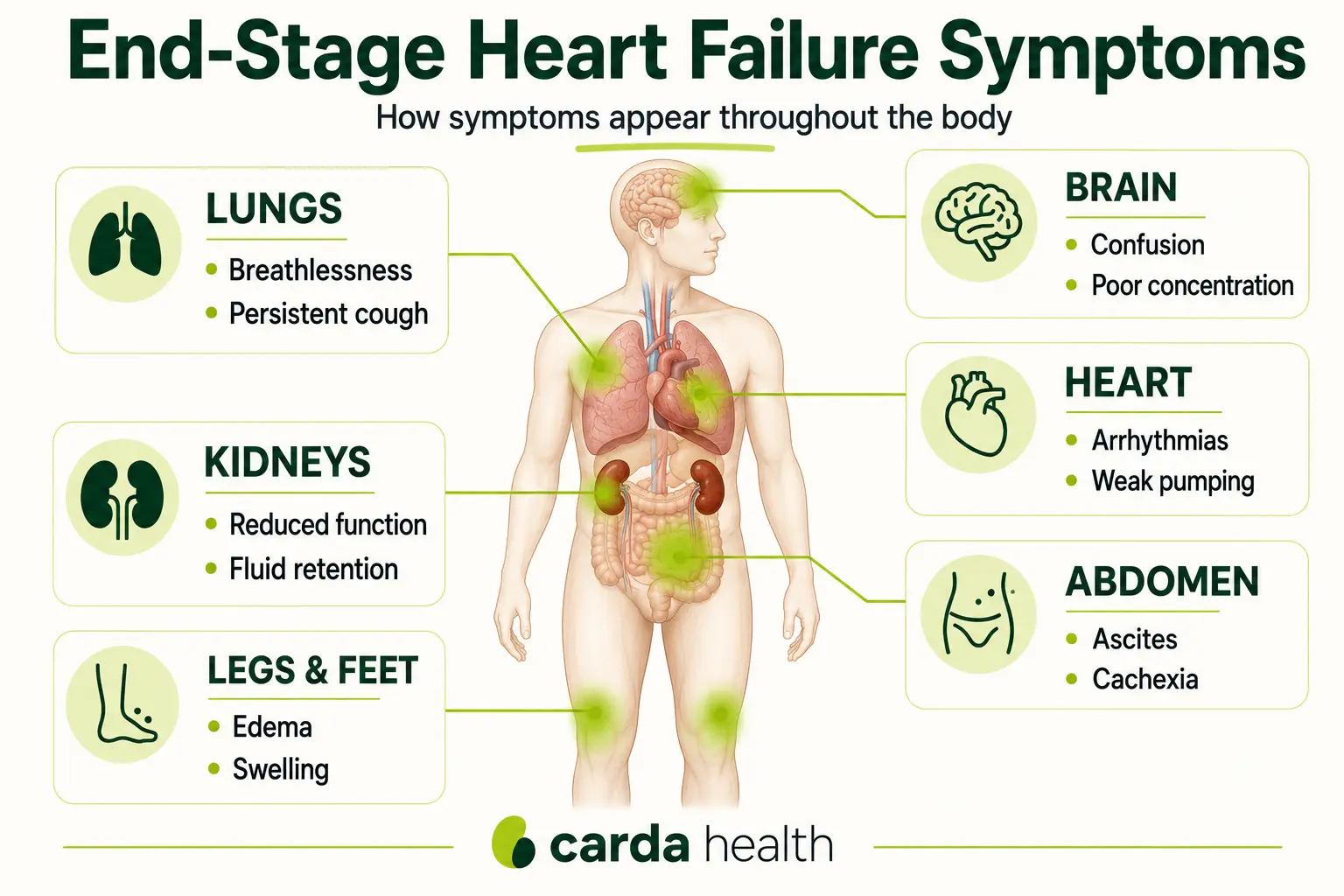 Body diagram showing where each end-stage heart failure symptom manifests, including lungs, legs, brain, heart, kidneys, and abdomen