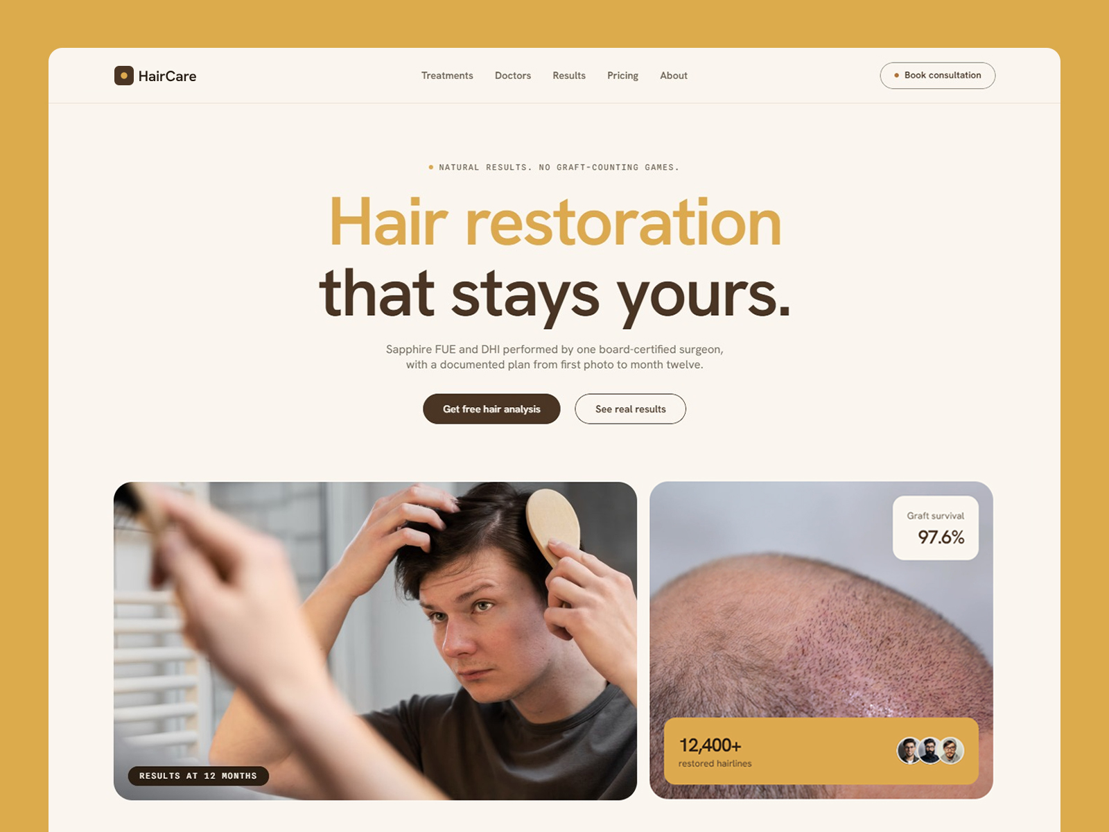 Hair Transplant Clinic Website Template