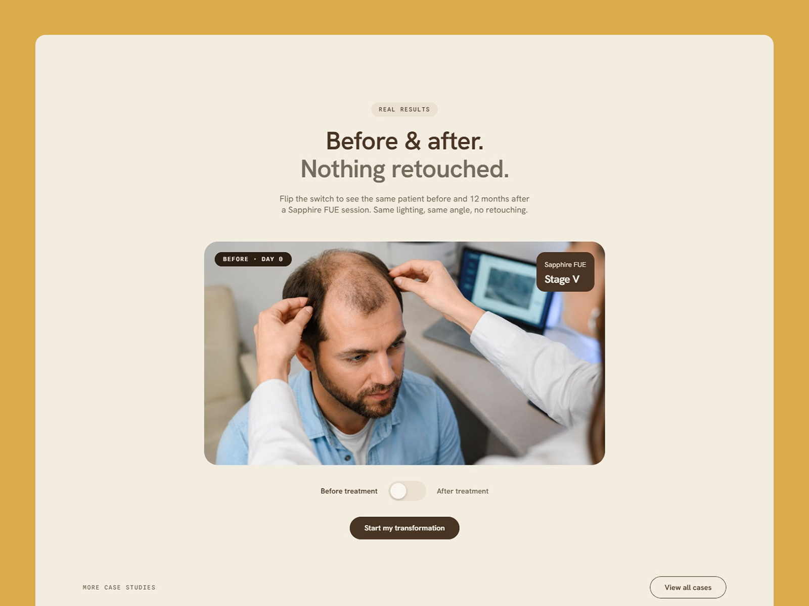 Modern Hair Transplant & Restoration Website Template