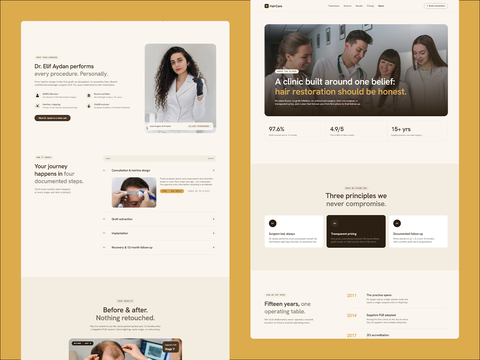 Hair Restoration & Transplant Website Template