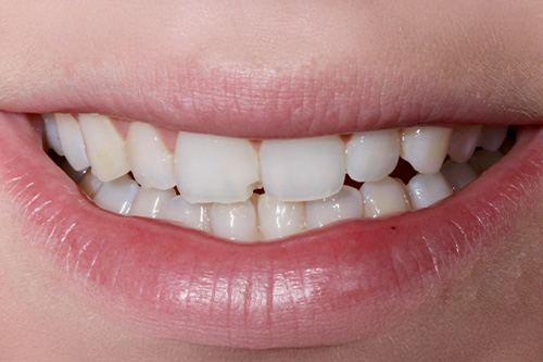 before and after treatment