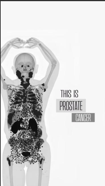 Targeted isotope therapies for cancer treatments