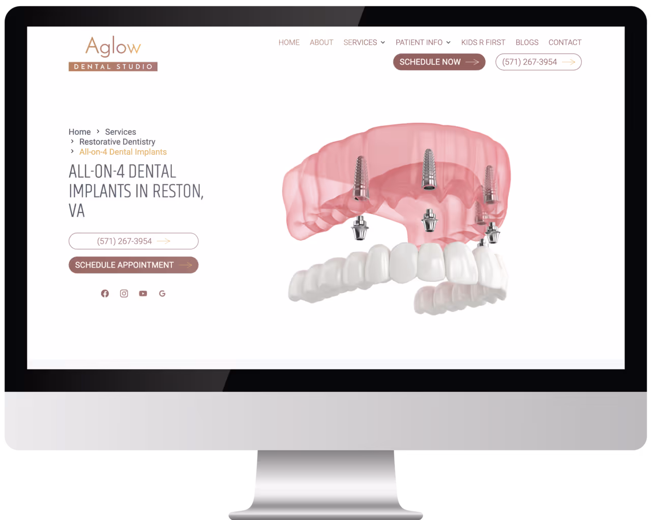 Top 5 PPC Campaigns for Dentists That Actually Work