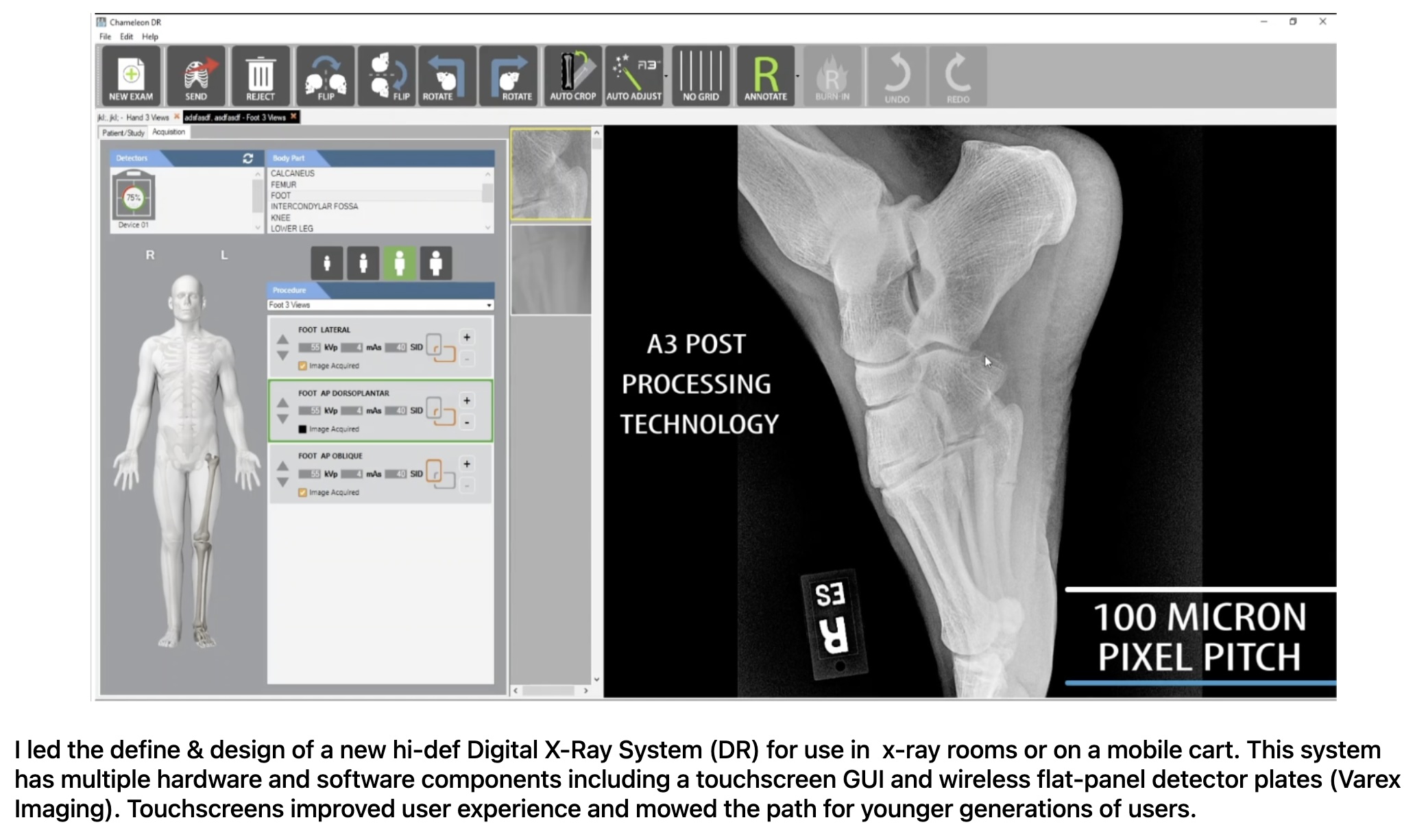 screen shot of the UI for Chameleon DR, hi-res digital x-ray system