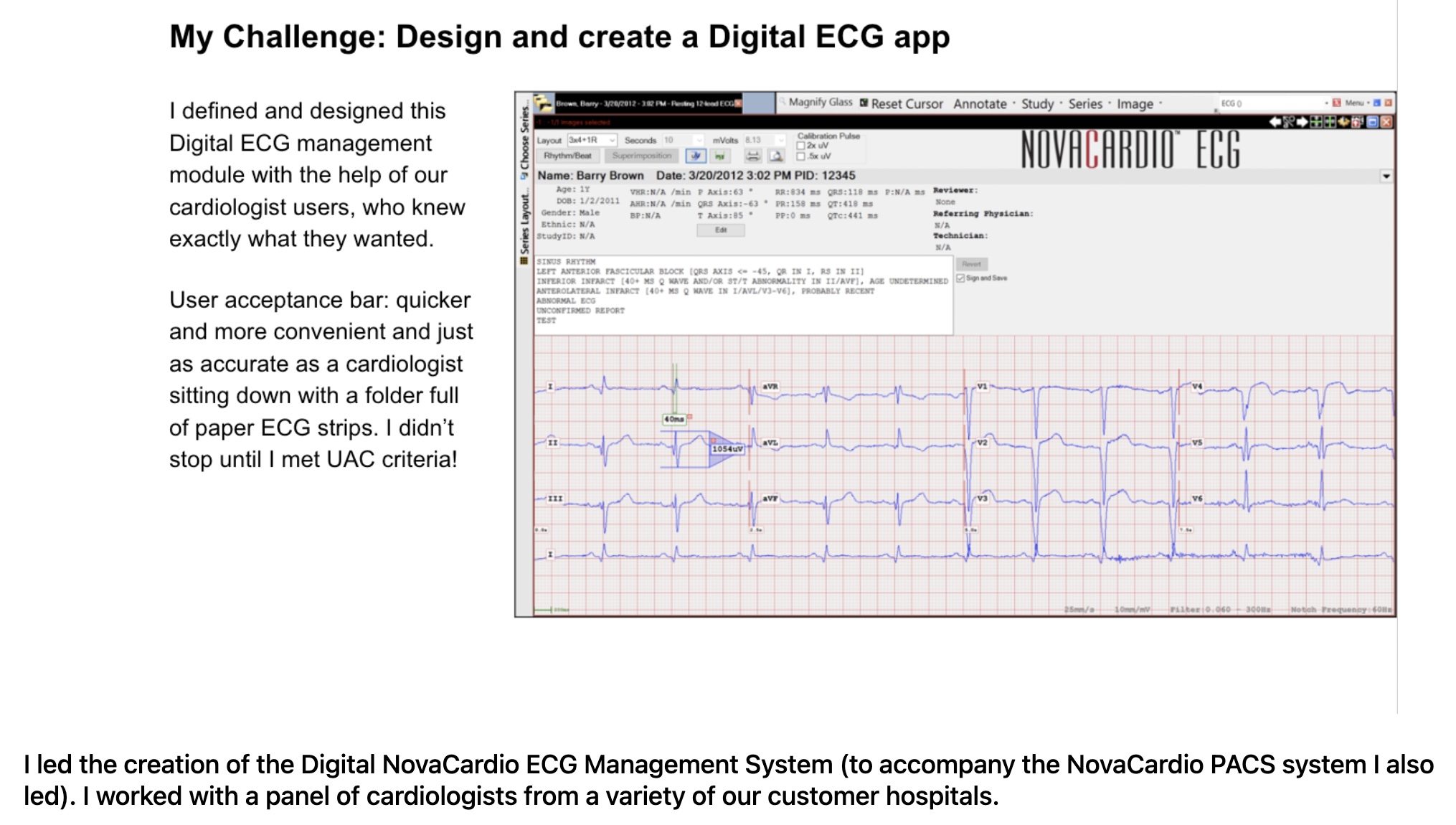 electrocardiogram management system