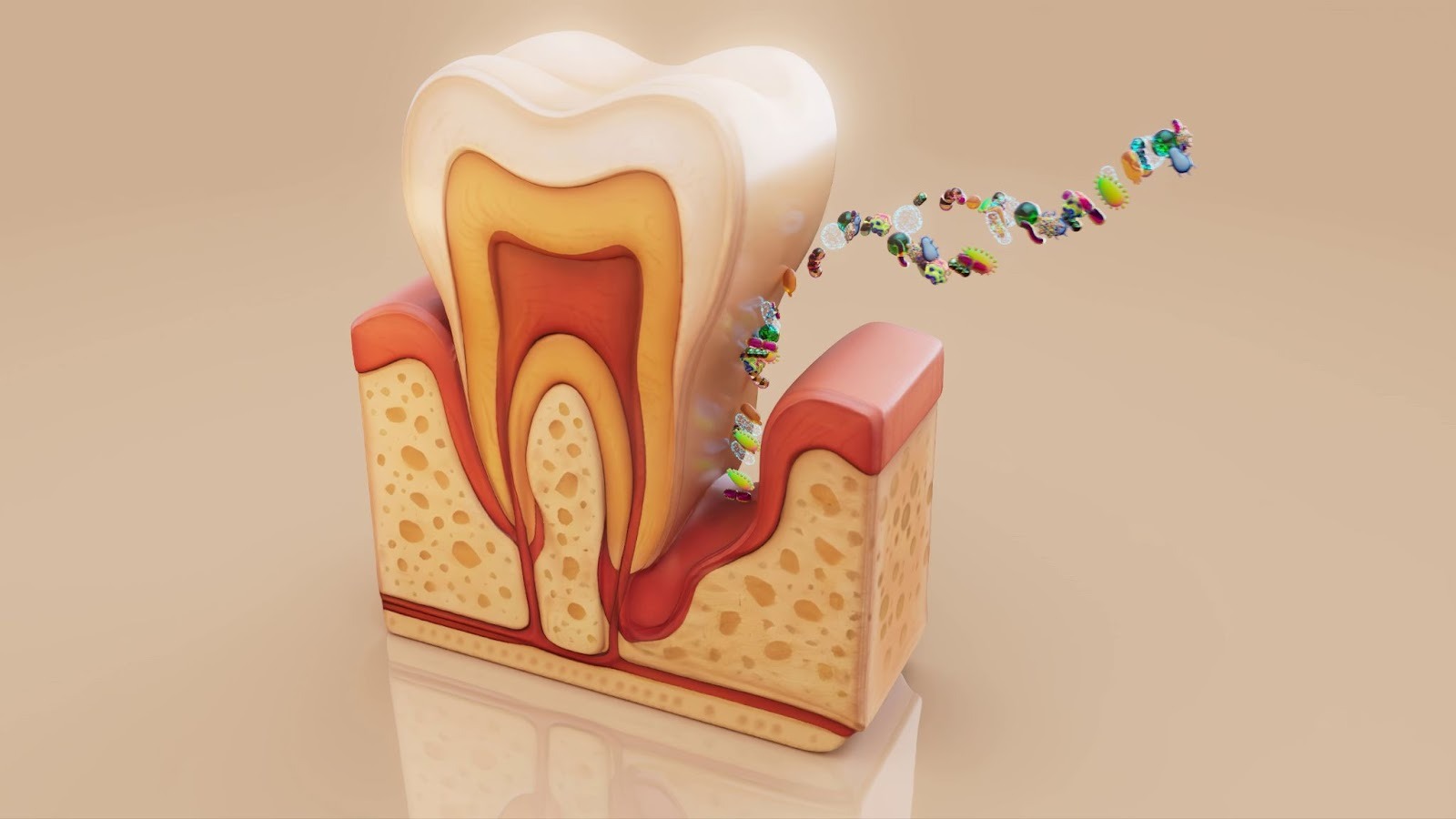 3D diagram of bacteria entering the gum line causing periodontal disease.