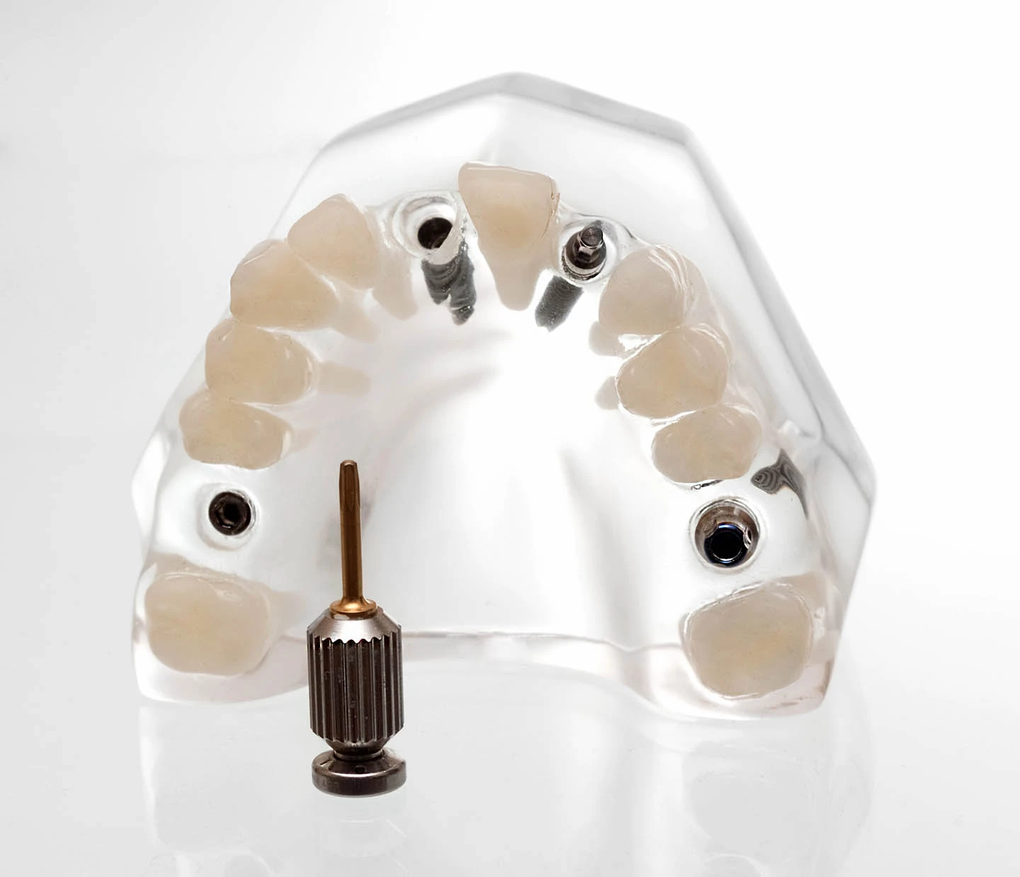 Clear dental implant model showing an upper jaw with teeth and a metal driver tool.