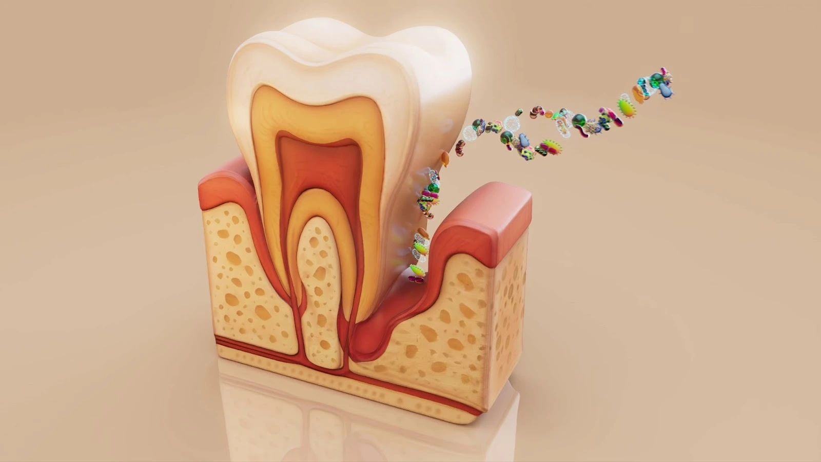Tooth cross-section diagram showing bacteria invading the gum line and root.