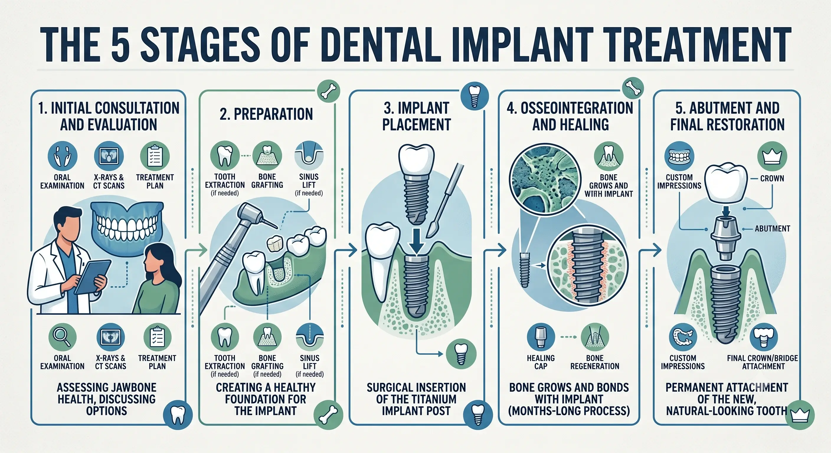 Infographic illustrating the 5 stages of dental implant treatment.