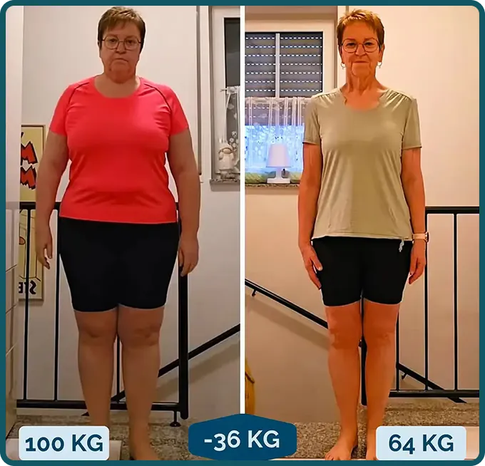 Neben-neben-Fotos einer Frau vor und nach einer Gewichtsabnahme von 36 kg, die einen deutlichen Gewichtsverlust zeigen 