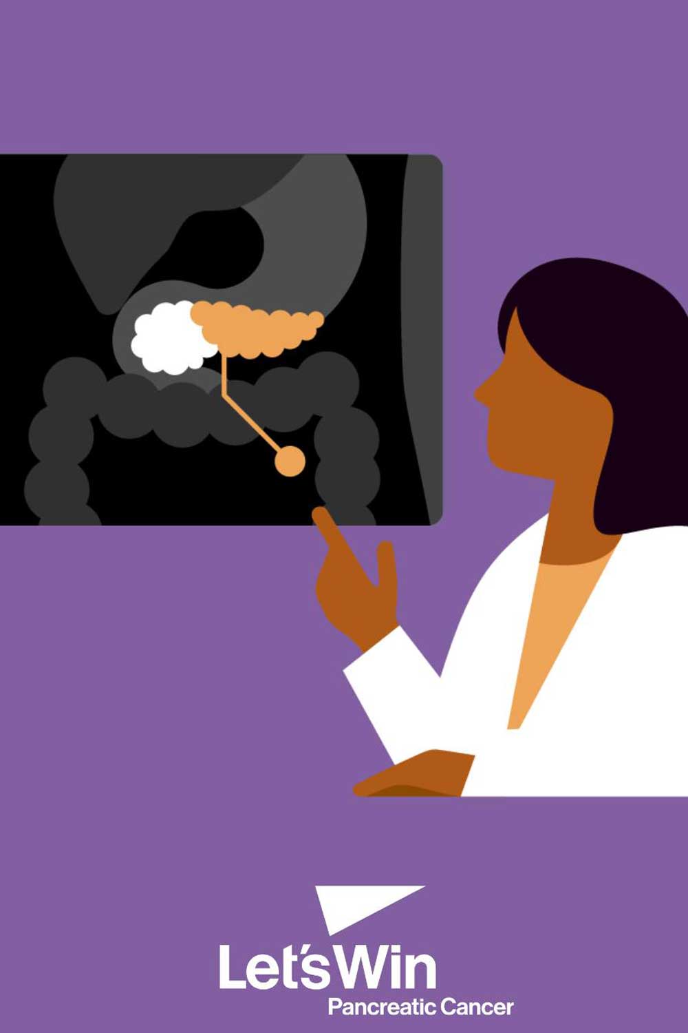 Illustration of a healthcare professional pointing to a diagram highlighting the pancreas in the digestive system, with text reading 'Let's Win Pancreatic Cancer'.