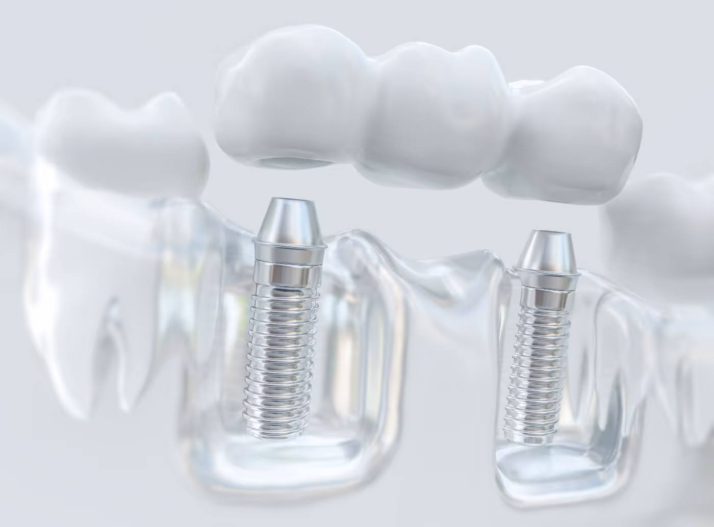 restorative dentistry in niwot